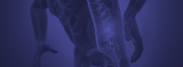 Coluna vertebral afetada por espondiloartrite